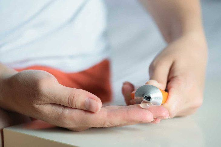 Woman is applying a anesthetic gel on her hand close up.